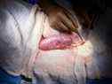 Un rein de porc génétiquement modifié semble en bonne santé lors d'une opération de transplantation à NYU Langone à New York, sur cette photo non datée. 