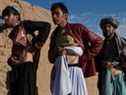 Sur cette photo prise le 4 février 2022, des hommes afghans qui ont vendu leurs reins posent pour une photo montrant leurs cicatrices de l'opération au bazar de Sayshanba dans le district d'Injil de la province de Herat. 