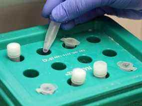 La technologiste de laboratoire médical Danielle Lalonde manipule des échantillons pour les tests COVID-19 à l'hôpital général de Belleville à Belleville, en Ontario, le 25 août 2020