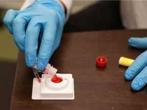 Un test rapide de dépistage du VIH et une prise de sang sont effectués au Sexual Health Saskatoon.  Photo prise à Saskatoon le 15 octobre 2020.
