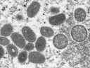 Le monkeypox, représenté sur une image au microscope électronique, est une maladie virale liée à la variole mais moins infectieuse et moins mortelle.