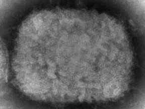 Cette image au microscope électronique de 2003 mise à disposition par les Centers for Disease Control and Prevention montre un virion du monkeypox, obtenu à partir d'un échantillon associé à l'épidémie de chiens de prairie de 2003.  Le monkeypox, une maladie qui apparaît rarement en dehors de l'Afrique, a été identifié ces derniers jours par les autorités sanitaires européennes et américaines.