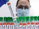 Le Québec dit administrer le vaccin antivariolique Imvamune aux «contacts à haut risque» de cas confirmés ou probables de monkeypox.
