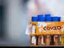 Des échantillons à tester pour le COVID-19 sont vus dans un laboratoire de Surrey, en Colombie-Britannique, le 26 mars 2020.
