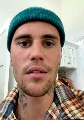 Justin Bieber a révélé qu'il était atteint du syndrome de Ramsay Hunt.