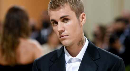 Justin Bieber révèle une paralysie faciale "grave" due au syndrome de Ramsay Hunt