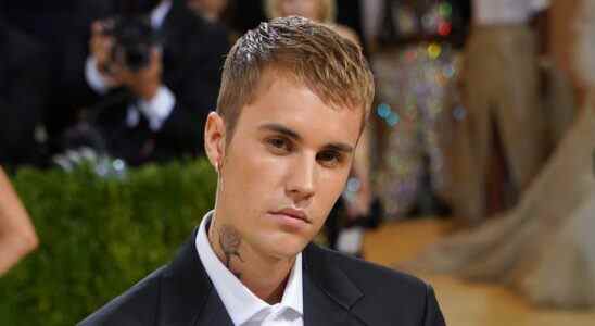 Justin Bieber prend l'été pour se remettre d'une paralysie faciale
