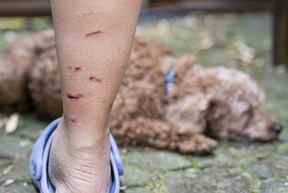 Les marques de perforation sur les jambes de Joyce Gee continuent de guérir après qu'une attaque de raton laveur non provoquée l'a blessée, elle et son chien.