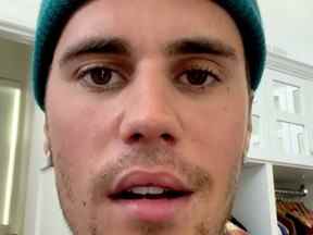 Justin Bieber - de son Instagram - 10 juin 2022 - montrant les effets de la paralysie faciale