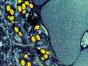 Une micrographie électronique à transmission colorisée de particules de monkeypox (jaune) trouvées dans une cellule infectée (bleue) est montrée dans une photo prise au NIAID Integrated Research Facility (IRF) à Fort Detrick, Maryland. 