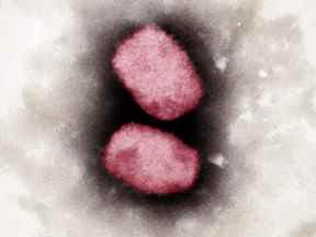 Cette photo prise en 2001 et reçue le lundi 23 mai 2022 de l'Institut Robert Koch montre une capture colorée au microscope électronique du virus monkeypox.