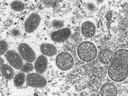 Cette image au microscope électronique de 2003 mise à disposition par les Centers for Disease Control and Prevention montre des virions de monkeypox matures de forme ovale, à gauche, et des virions immatures sphériques, à droite, obtenus à partir d'un échantillon de peau humaine associé à l'épidémie de chien de prairie de 2003.  (Cynthia S. Goldsmith, Russell Regner/CDC via AP)