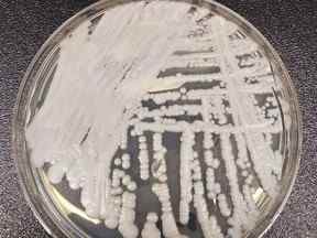 Cette photo non datée mise à disposition par les Centers for Disease Control and Prevention montre une souche de Candida auris cultivée dans une boîte de Pétri dans un laboratoire du CDC.