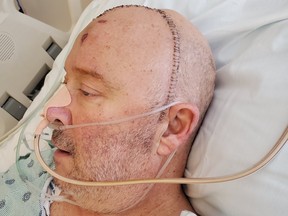 Marco Rushton après une opération au cerveau à l'hôpital John Hopkins aux États-Unis.  Photo gracieuseté de la famille Rushton.