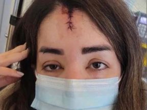 Elnaz Hajtamiri est vue après une agression le 20 décembre 2021 dans son parking de Richmond Hill.