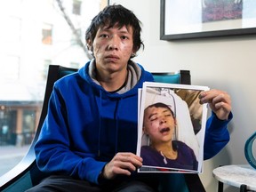 Pacey Dumas lors d'une entrevue à Edmonton le 2 novembre 2021, tient une photo de lui à l'hôpital après qu'un coup de pied d'un agent du service de police d'Edmonton lui a laissé un trou dans le crâne.  Ian Kucerak/Postmédia