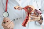 Un médecin tient un modèle en coupe des organes reproducteurs féminins.
