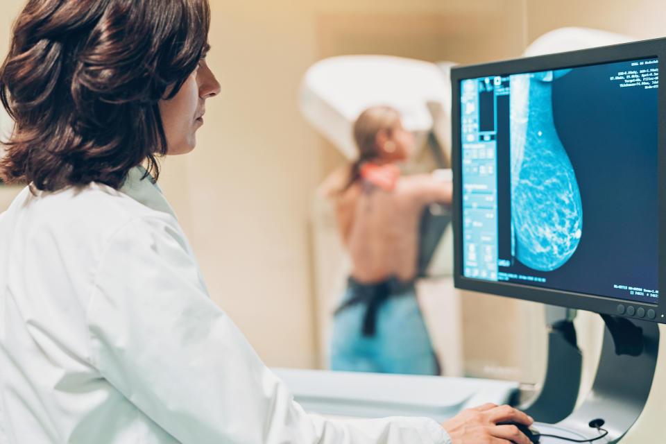 Les dépistages mammaires sont essentiels pour aider à détecter le cancer du sein à un stade précoce.  (Getty Images)