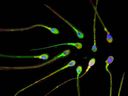 Ce sont des spermatozoïdes colorés avec un colorant fluorescent afin de pouvoir les étudier plus facilement. 