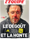 Une du journal L'Equipe le 30 octobre 2023 avec une photo du visage ensanglanté de Fabio Grosso.