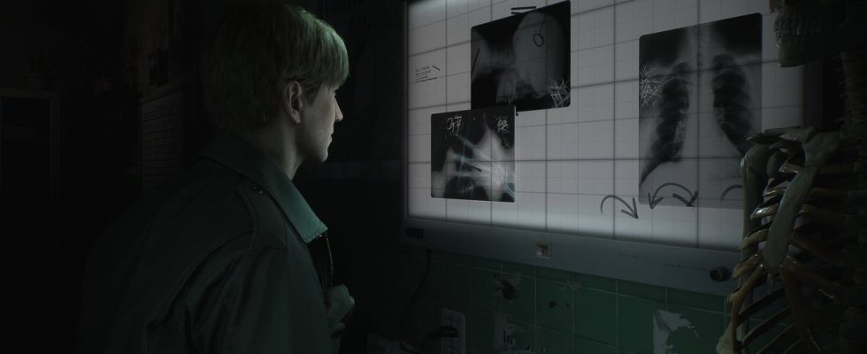 L'équipe Bloober demande de la patience aux fans sur Silent Hill 2 Remake et affirme que les choses "avancent sans problème"