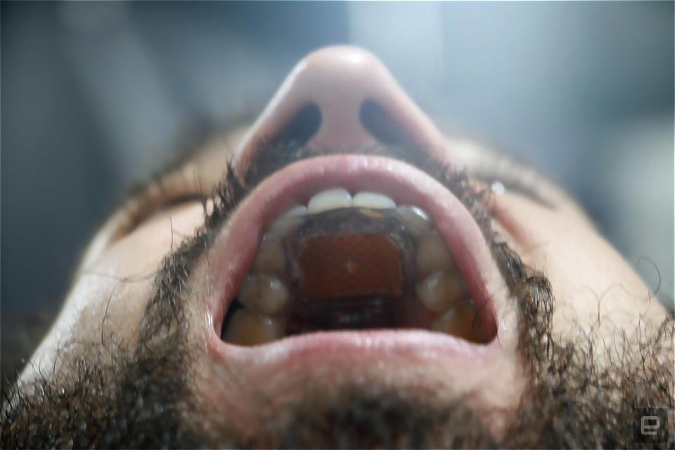 Un aperçu du MouthPad à l'intérieur de la bouche d'une personne.