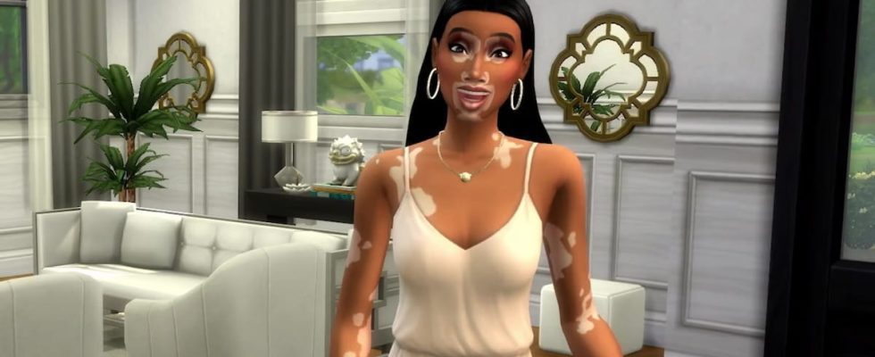 The Sims 4 Delivery Express vitiligo features