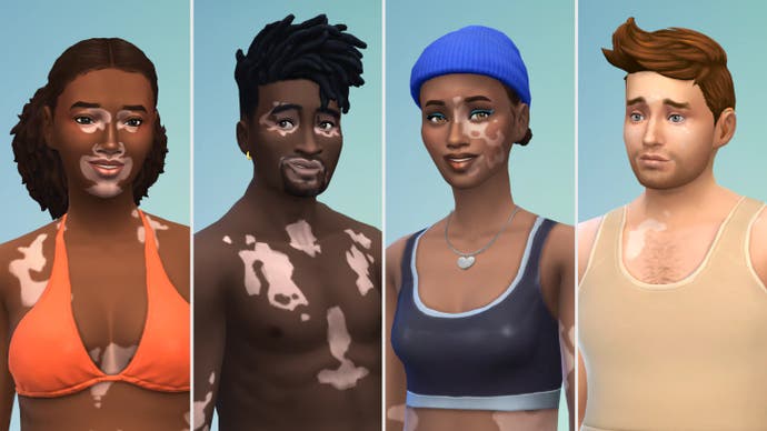 Exemples de vitiligo dans Les Sims 4 (visage)