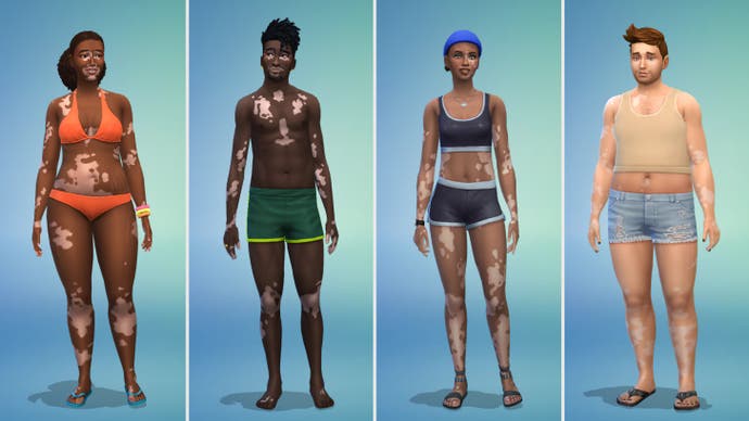 Exemples de vitiligo dans Les Sims 4 (corps)
